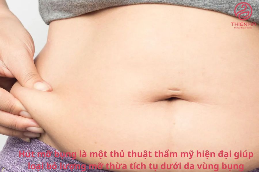 Hút mỡ bụng có nguy hiểm không? Giải đáp từ chuyên gia thẩm mỹ 1 Hút mỡ bụng là gì ?