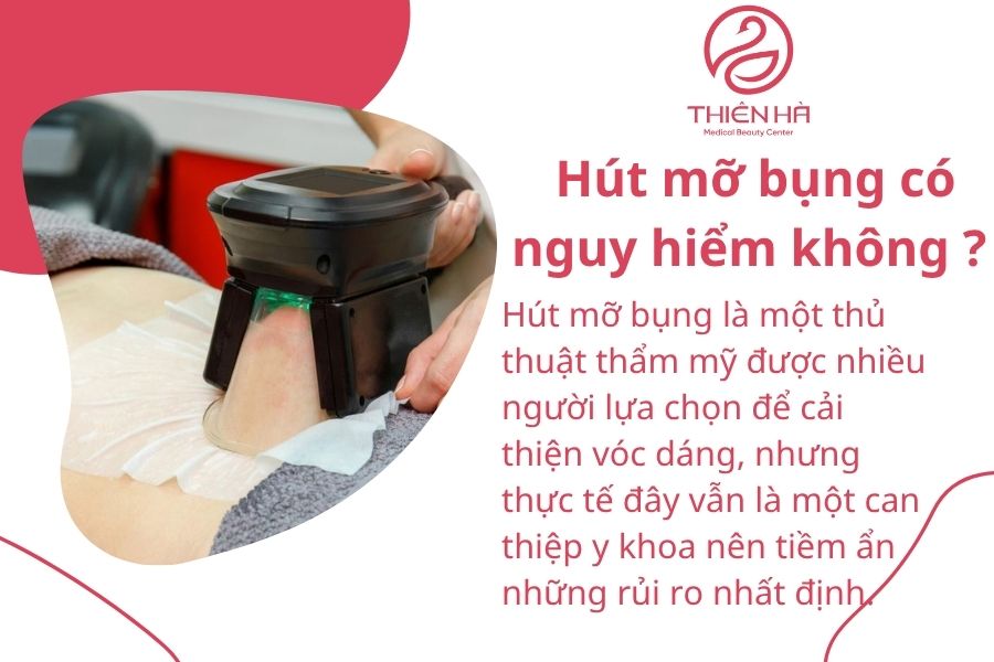Hút mỡ bụng có nguy hiểm không? Giải đáp từ chuyên gia thẩm mỹ 2 Hút mỡ bụng có nguy hiểm không