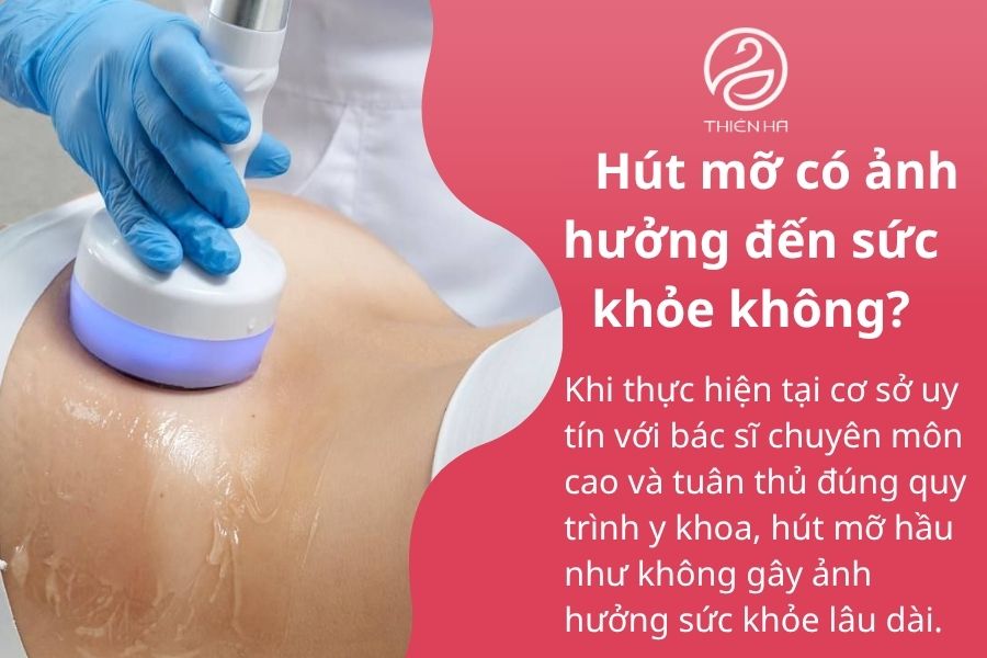 Một số câu hỏi thường gặp về hút mỡ