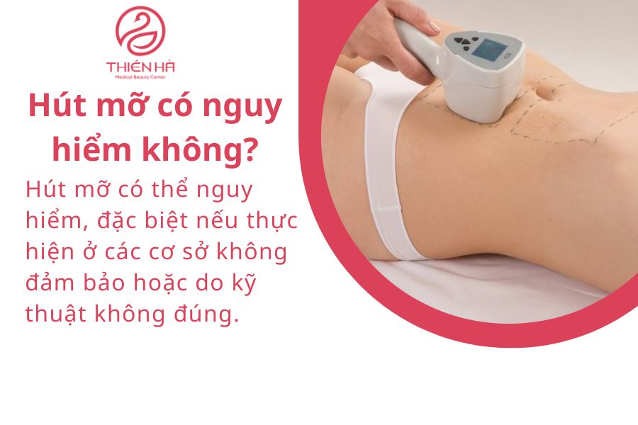 Hút mỡ có nguy hiểm không?