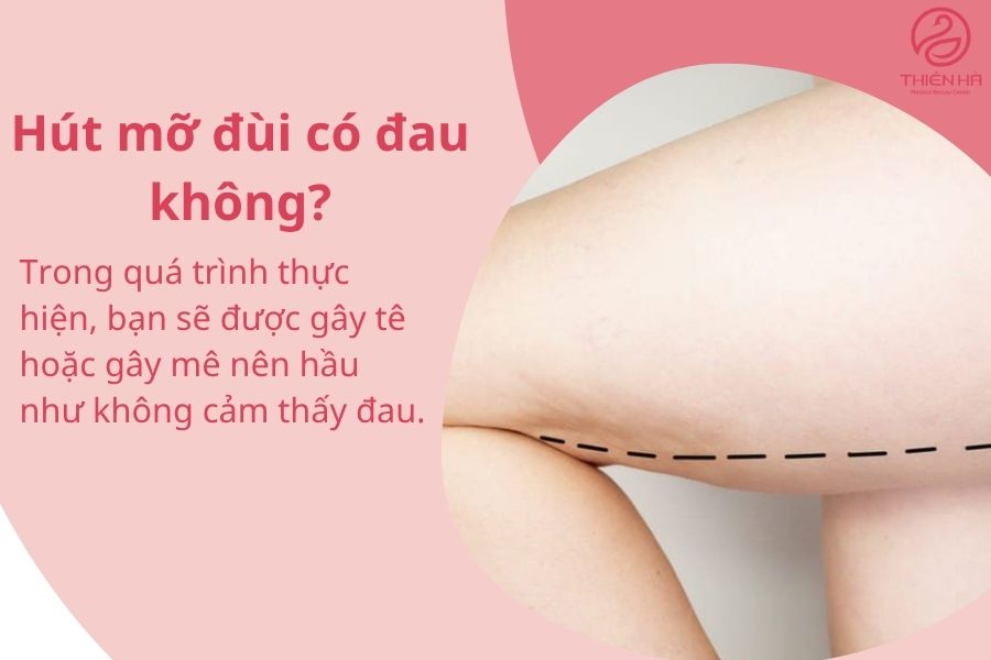 Hút mỡ đùi là gì? Quy trình, chi phí và hiệu quả thực tế 7 Một số câu hỏi thường gặp về hút mỡ đùi