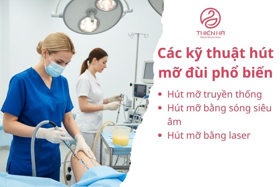 Hút mỡ đùi là gì? Quy trình, chi phí và hiệu quả thực tế 3 Các kỹ thuật hút mỡ đùi phổ biến