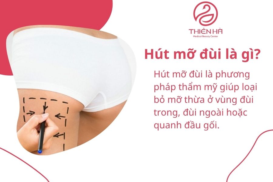 Hút mỡ đùi là gì? Quy trình, chi phí và hiệu quả thực tế 1 Hút mỡ đùi là gì?