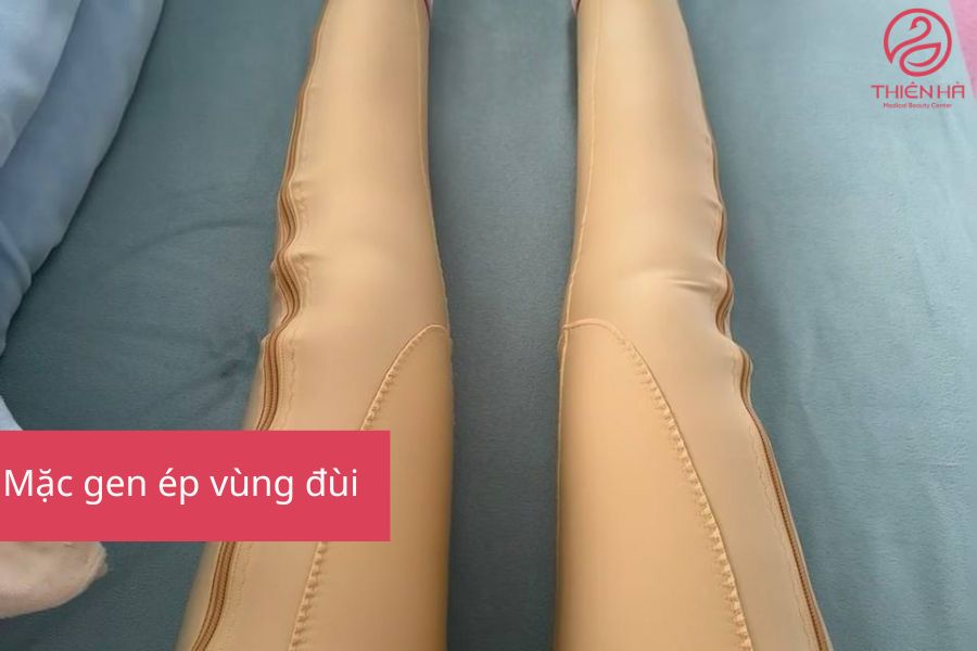 Hút mỡ đùi là gì? Quy trình, chi phí và hiệu quả thực tế 6 Mặc gen ép vùng đùi