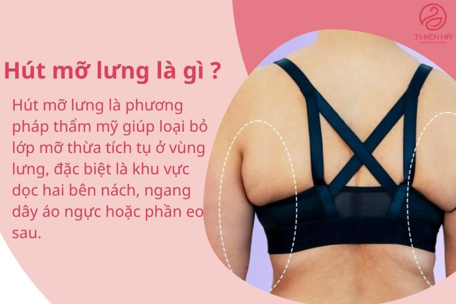 Hút mỡ lưng là gì? Giải pháp giúp tấm lưng phẳng mịn, thon gọn 1 Hút mỡ lưng là gì ?