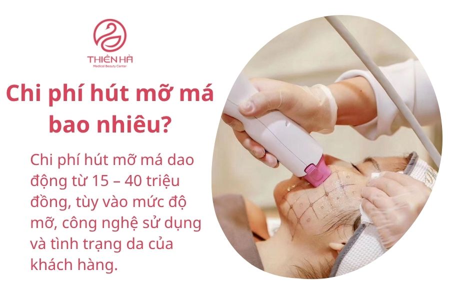 Hút mỡ má an toàn – Giải pháp giúp khuôn mặt thon gọn V-Line 4 Chi phí hút mỡ má bao nhiêu?