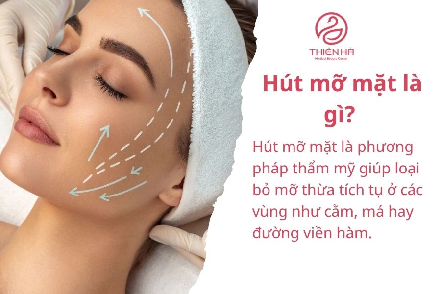 Hút mỡ mặt là gì? Giải pháp thu gọn khuôn mặt nhanh, an toàn 1 Hút mỡ mặt là gì?