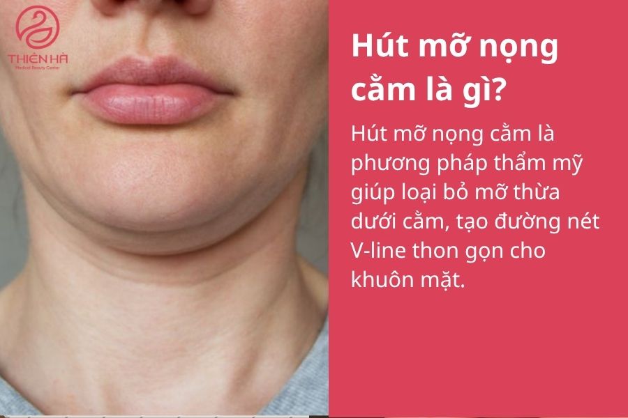 Hút mỡ nọng cằm là gì? Tất tần tật thông tin bạn cần biết 1 Hút mỡ nọng cằm là gì?