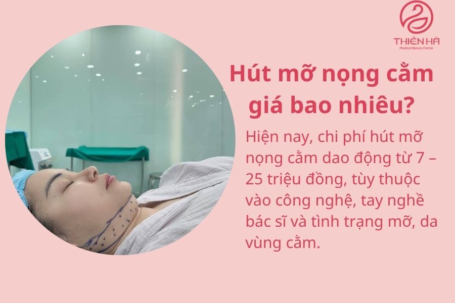 Hút mỡ nọng cằm là gì? Tất tần tật thông tin bạn cần biết 4 Hút mỡ nọng cằm giá bao nhiêu?