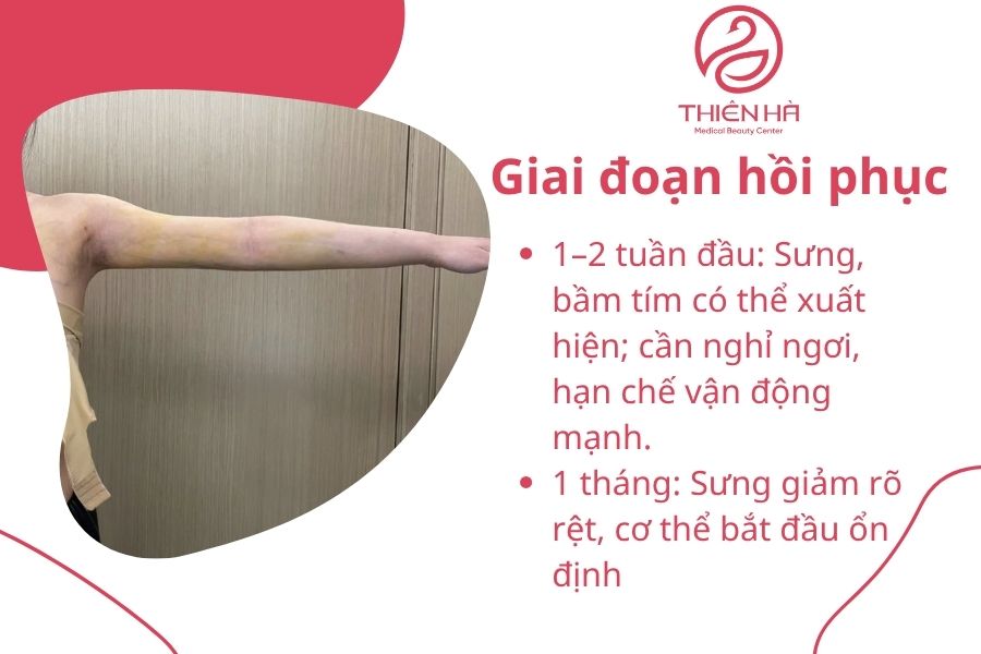 Giai đoạn hồi phục 