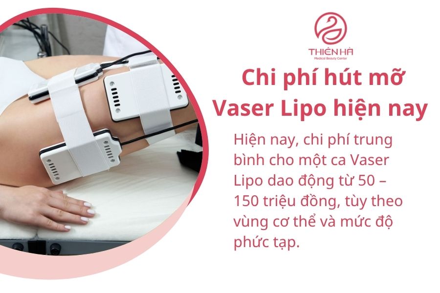 Chi phí hút mỡ Vaser Lipo hiện nay