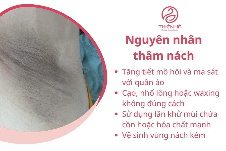 Nguyên nhân thâm nách