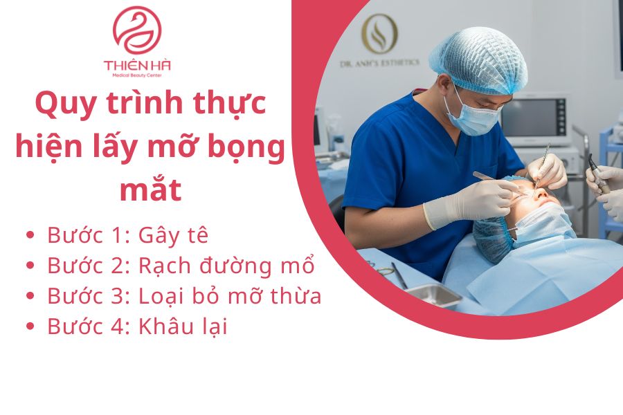 Quy trình lấy mỡ bọng mắt 