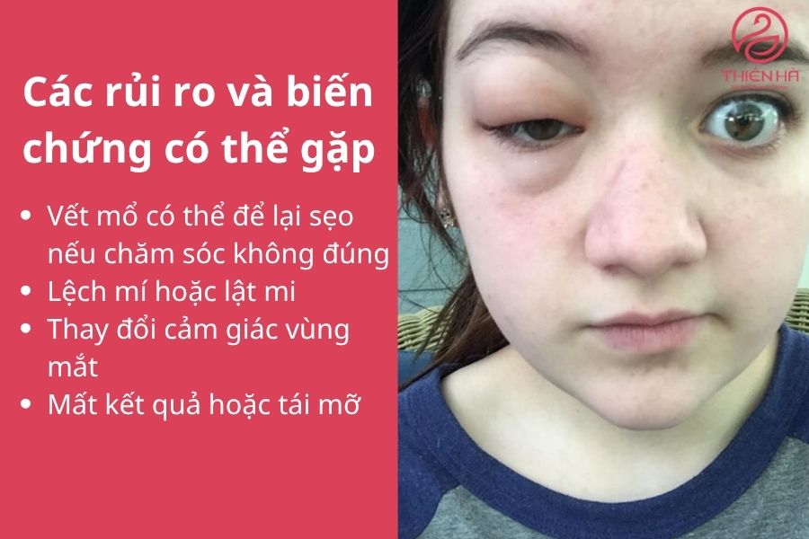 Rủi ro & biến chứng có thể gặp