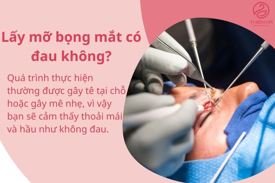 Một số câu hỏi thường gặp về lấy mỡ bọng mắt 