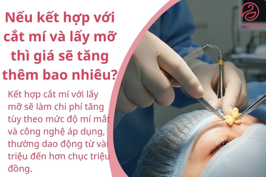 Một số câu hỏi thường gặp về lấy mỡ mí mắt trên