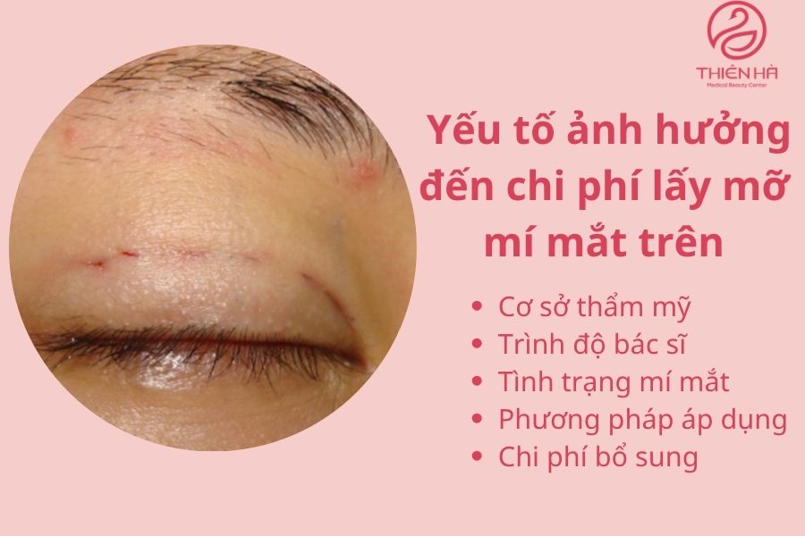 Các yếu tố ảnh hưởng đến chi phí lấy mỡ mí mắt trên 