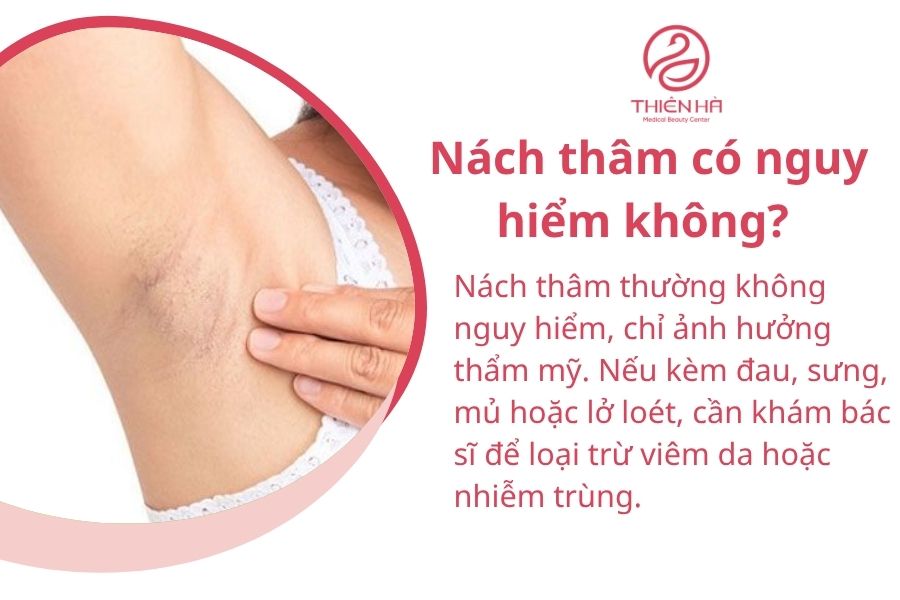 Nách thâm: Nguyên nhân, cách khắc phục nhanh & an toàn cho da dưới cánh tay 5 Một số câu hỏi thường gặp về nách thâm