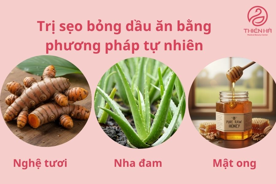 Sẹo bỏng dầu ăn: Giải pháp khắc phục từ dân gian đến công nghệ cao 3 Cách trị sẹo bỏng dầu ăn bằng phương pháp tự nhiên