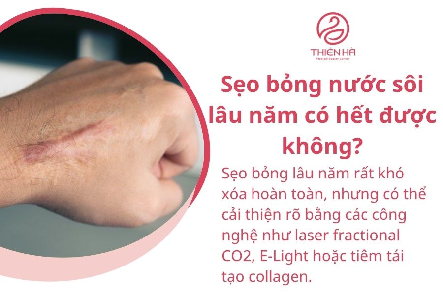 Cách xóa sẹo bỏng nước sôi an toàn, được Viện Thẩm Mỹ Thiên Hà tư vấn 7 Một số câu hỏi thường gặp