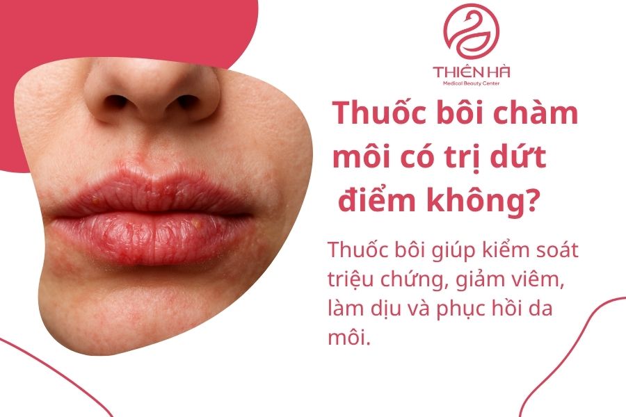 Top 7 thuốc bôi chàm môi hiệu quả, an toàn được bác sĩ khuyên dùng 8 Một số câu hỏi thường gặp về thuốc bôi chàm môi