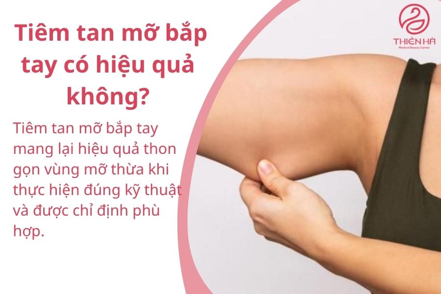 Một số câu hỏi thường gặp về tiêm tan mỡ bắp tay 
