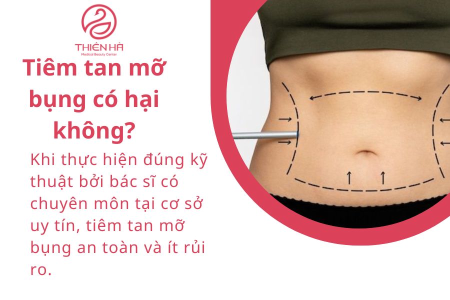 Một số câu hỏi thường gặp về tiêm tan mỡ bụng 