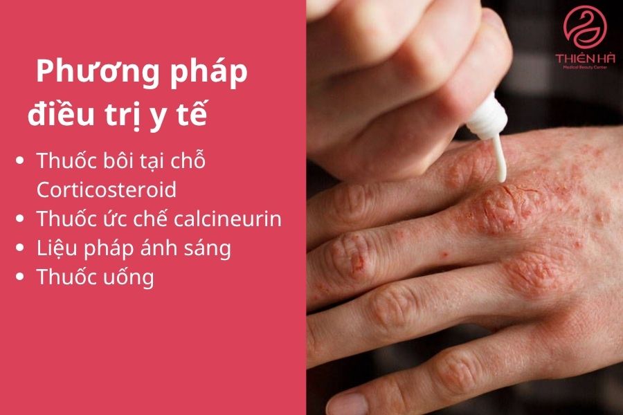 Trị chàm tận gốc uy tín và an toàn tại Viện Thẩm Mỹ Thiên Hà 2 Thuốc bôi tại chỗ