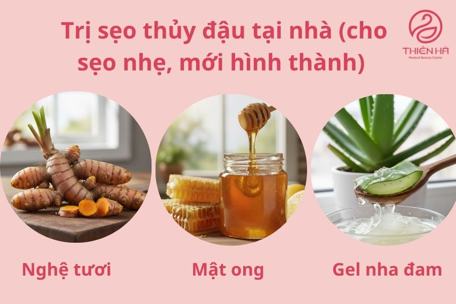 Trị sẹo thủy đậu hiệu quả: Từ mẹo tự nhiên đến công nghệ mới 3 Cách trị sẹo thủy đậu tại nhà (cho sẹo nhẹ, mới hình thành)