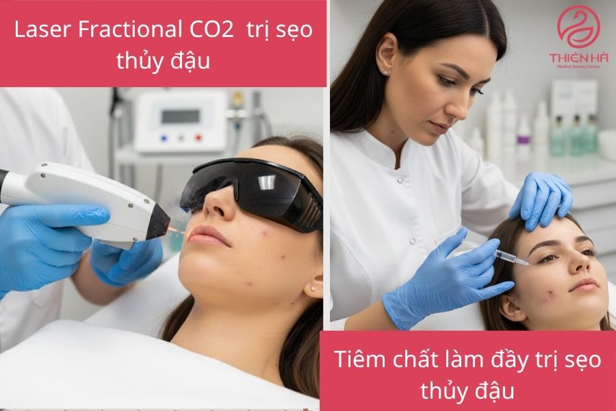 Trị sẹo thủy đậu hiệu quả: Từ mẹo tự nhiên đến công nghệ mới 5 Trị sẹo thủy đậu bằng công nghệ y khoa hiện đại