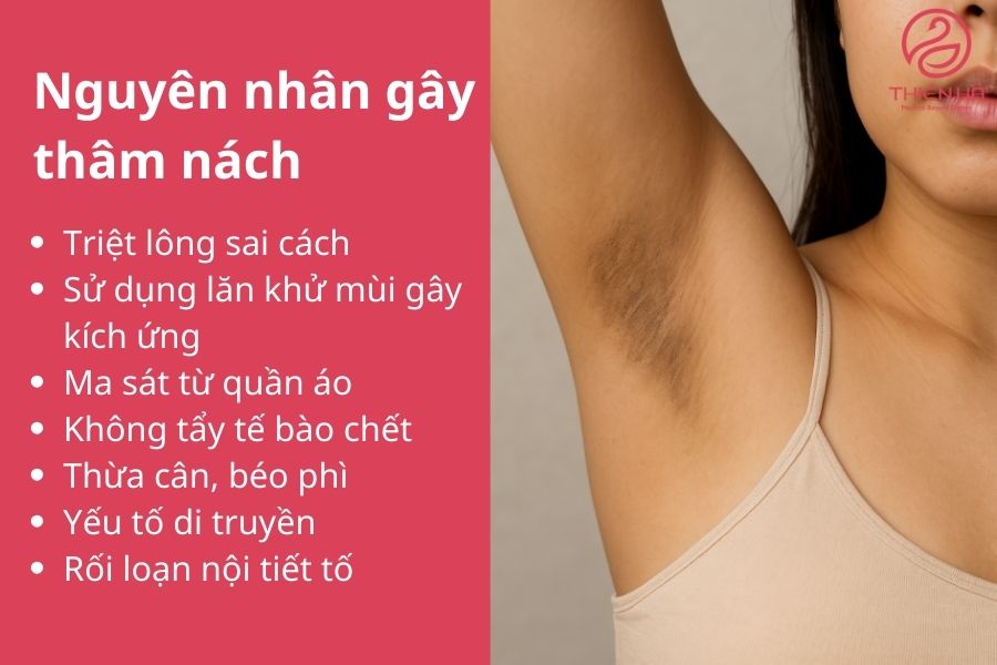 Nguyên nhân gây thâm nách