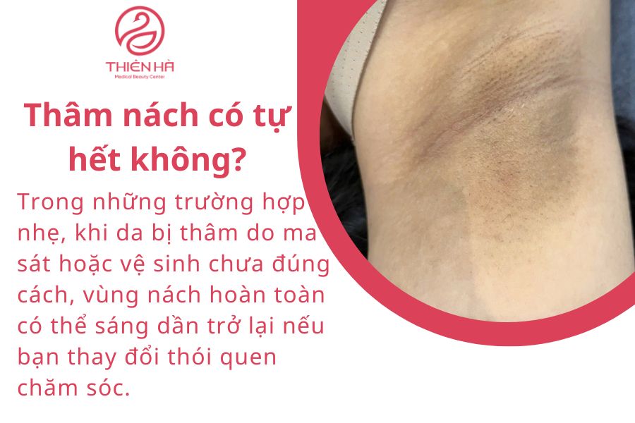 Thâm nách có tự hết không?