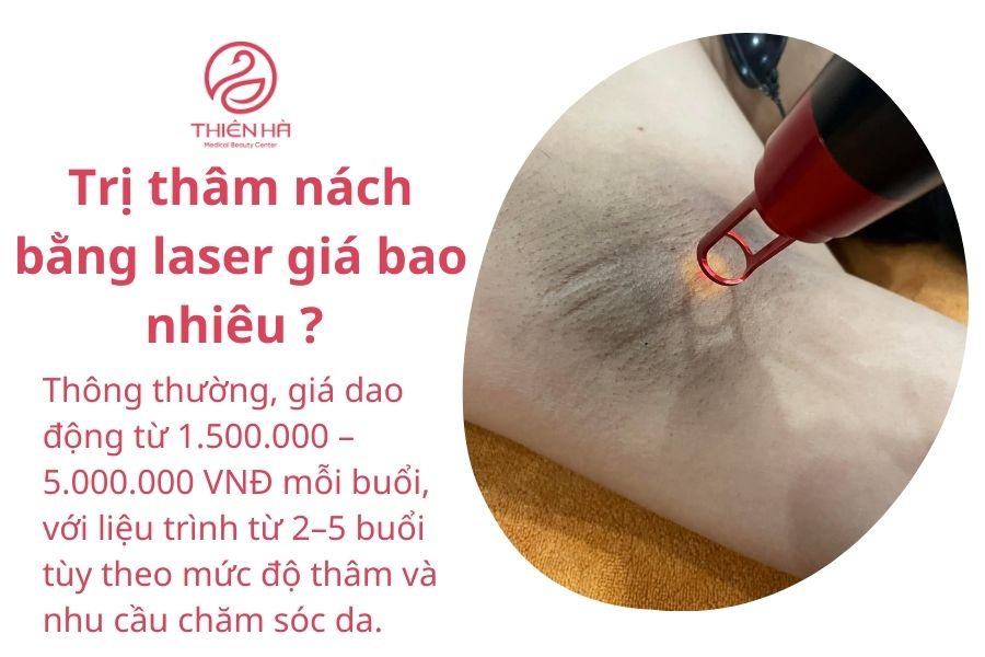 Trị thâm nách bằng laser giá bao nhiêu ? 