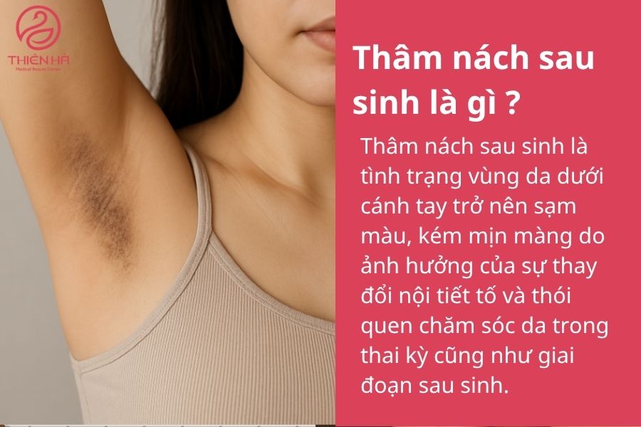 Thâm nách sau sinh là gì ?