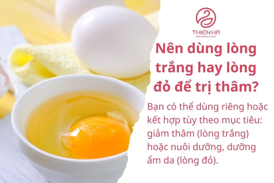 Một số câu hỏi thường gặp 