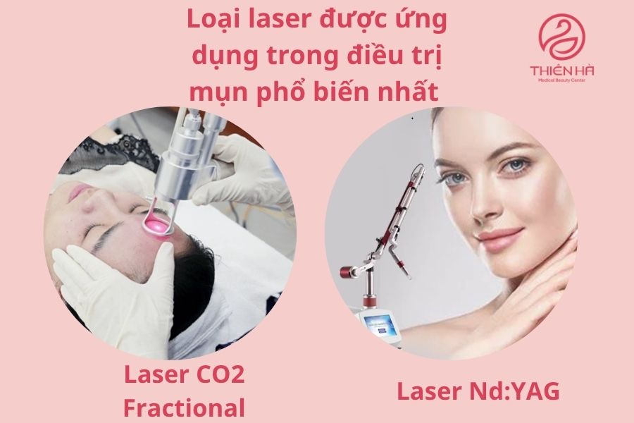 Bắn Tia Laser Trị Mụn: Hiệu Quả, Ưu Nhược Điểm & Chi Phí 1 Các loại tia laser trị mụn phổ biến