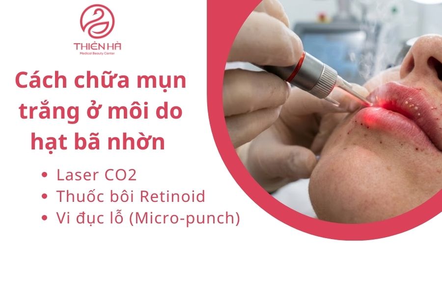 Cách chữa mụn trắng ở môi do hạt bã nhờn 
