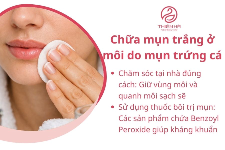 Cách chữa mụn trắng ở môi do mụn trứng cá