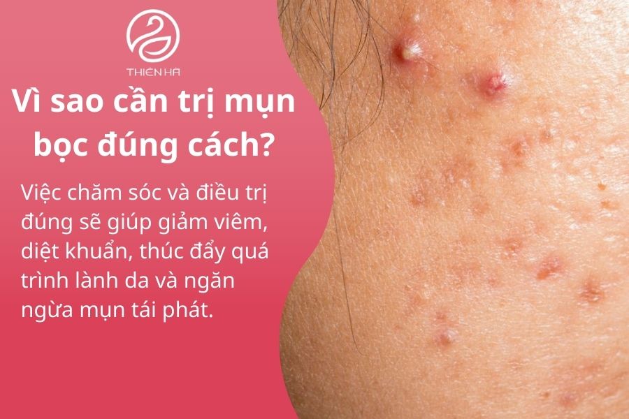 Vì sao cần trị mụn bọc đúng cách?