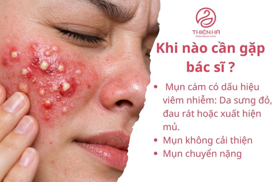 Dấu hiệu cần gặp bác sĩ 