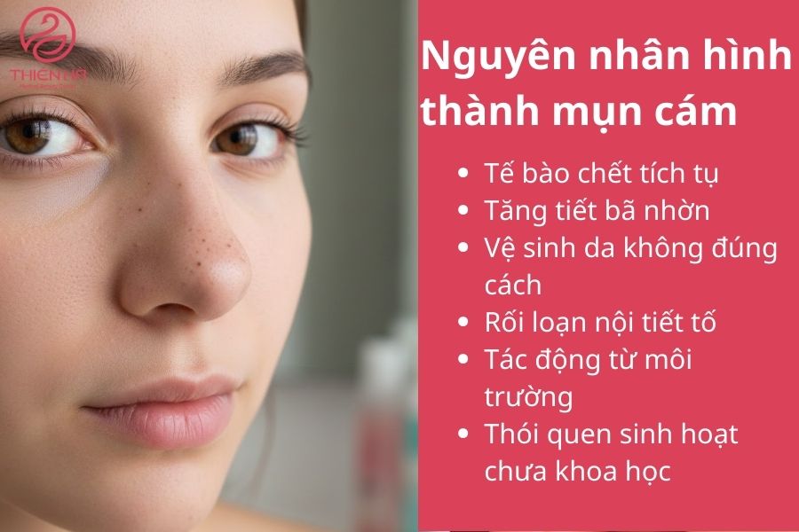 Nguyên nhân hình thành mụn cám