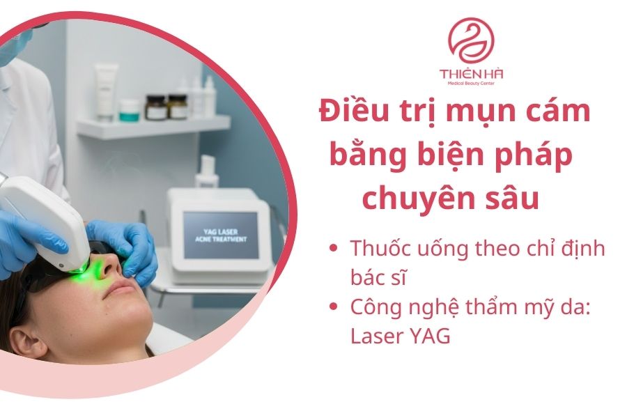 Cách điều trị mụn cám bằng biện pháp chuyên sâu 