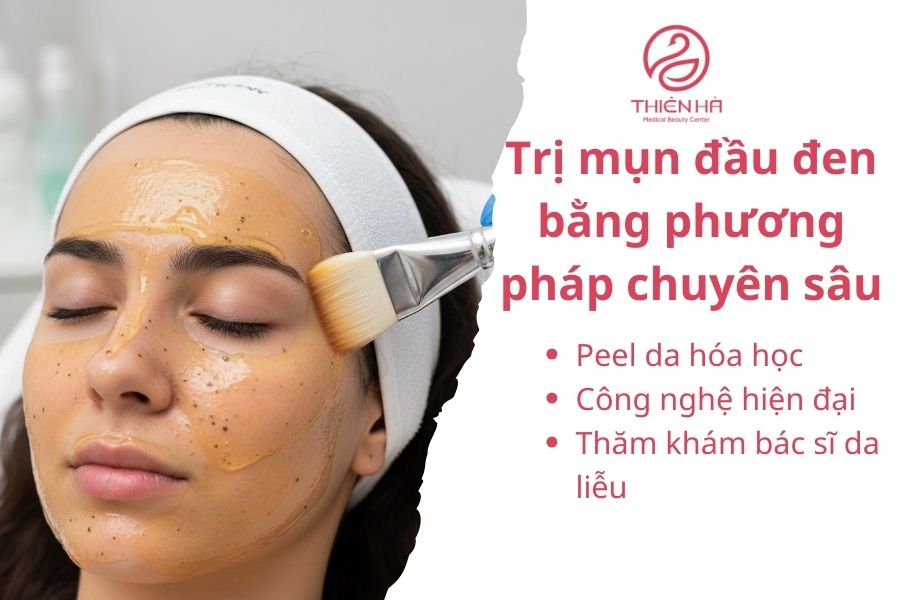 Trị mụn đầu đen bằng phương pháp chuyên sâu