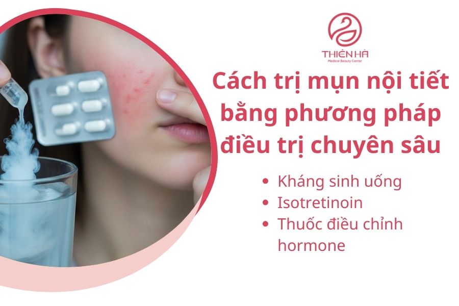 Cách trị mụn nội tiết bằng phương pháp điều trị chuyên sâu 