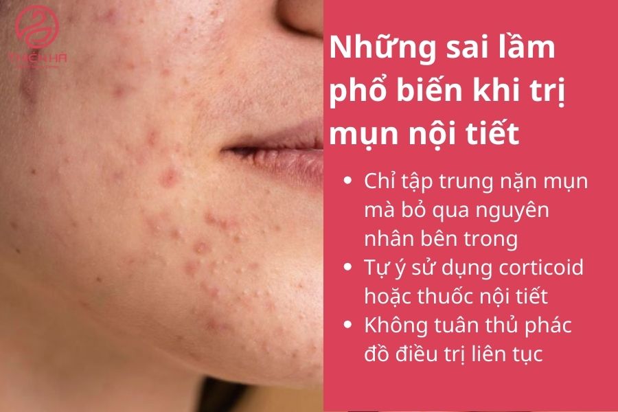 Những sai lầm phổ biến khi trị mụn nội tiết