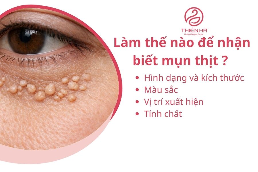 Làm thế nào để nhận biết mụn thịt ? 