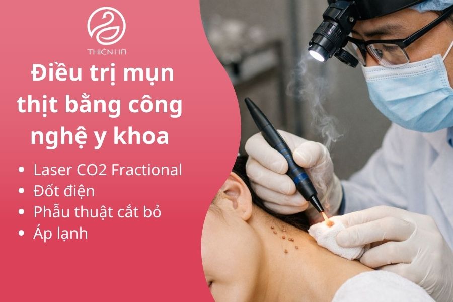 Điều trị mụn thịt bằng công nghệ y khoa