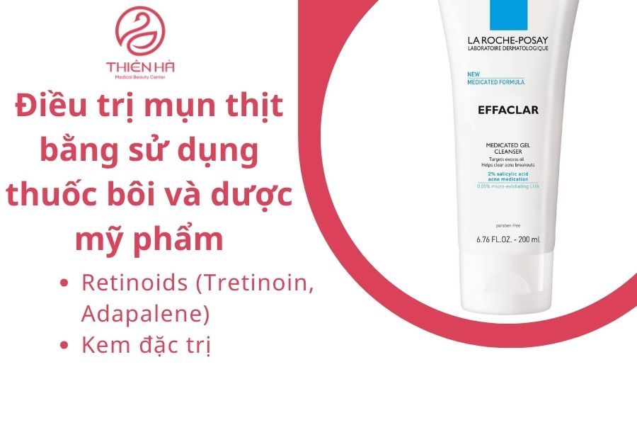 Điều trị mụn thịt bằng sử dụng thuốc bôi và dược mỹ phẩm