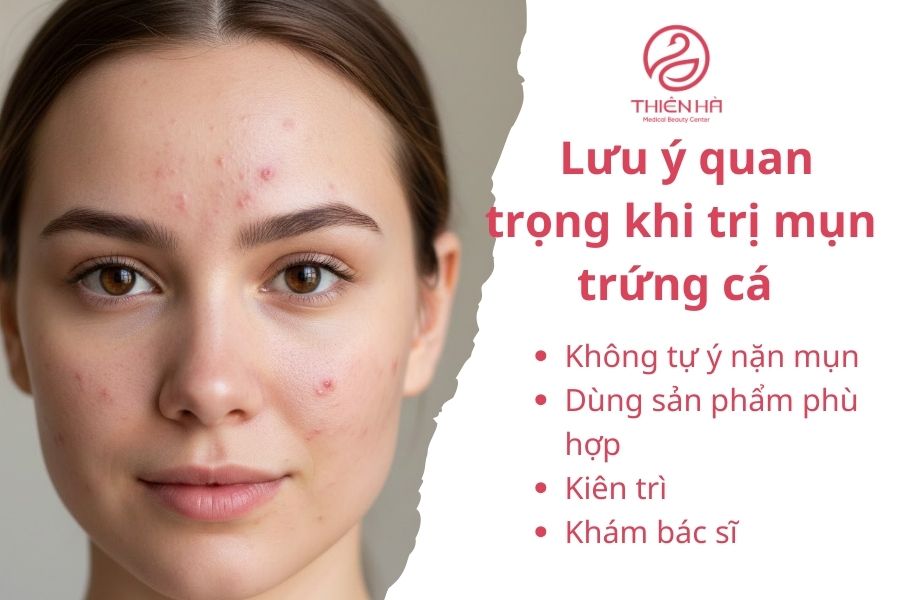 Lưu ý quan trọng khi trị mụn trứng cá 
