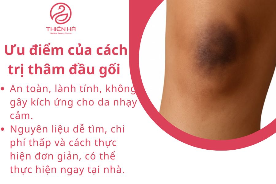 Ưu điểm của các cách trị thâm đầu gối 